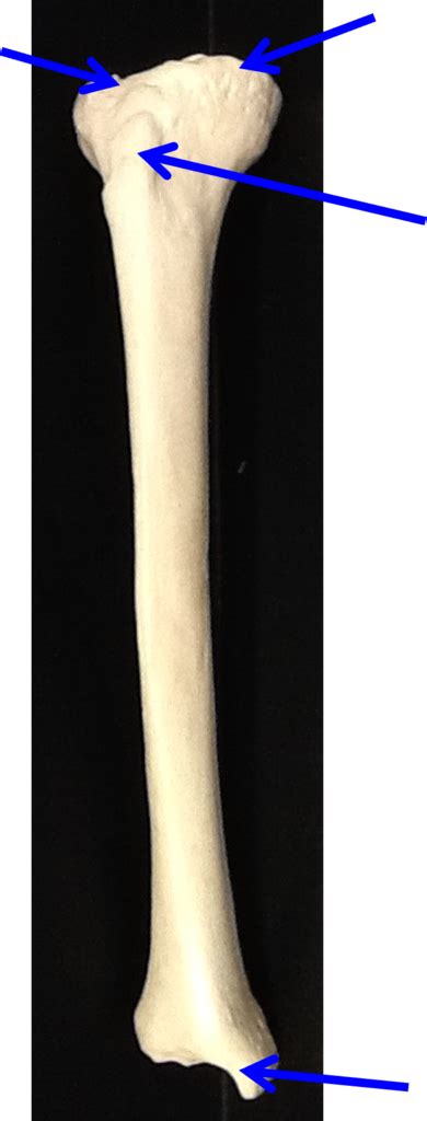 Image result for Ribstride Tibia