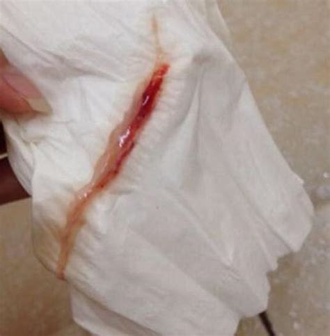 月經流出一團黑血?白帶異常? - 每日頭條