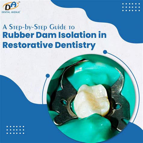 Rubber Dam Isolation Guide for Restorative Dentistry – Dental Avenue