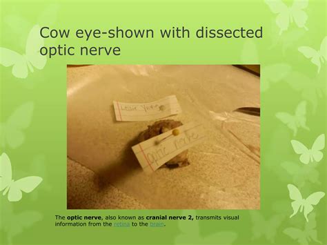 Cow eye - dissection and label | PPTX