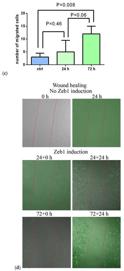 Proteomic Analysis of Zeb1 Interactome in Breast Carcinoma Cells