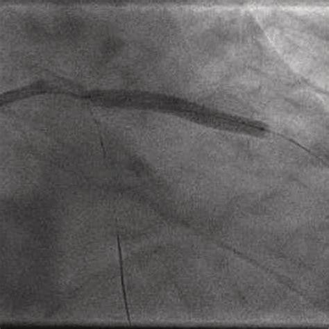 T-trendz Issue 2 / 2021 - Siemens Healthineers India