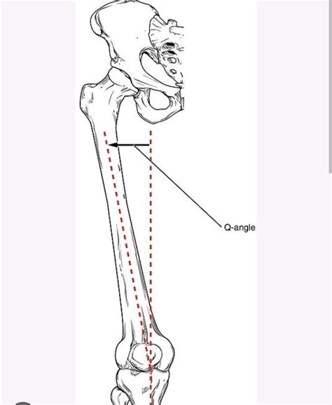 Dr. Neetu Rathi(Physiotherapist) auf LinkedIn: Q Angle: Q angle of the knee is a measurement of ...