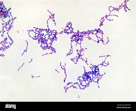 Streptococcus pyogenes bacteria, light micrograph. These are Gram ...