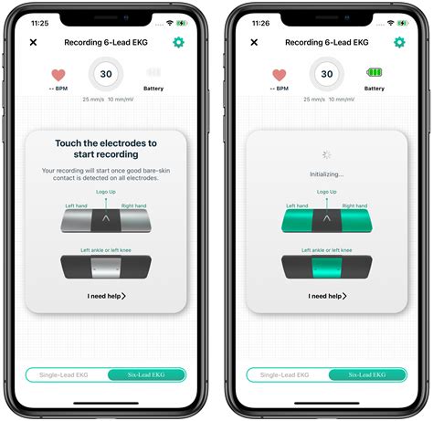 Setting up your KardiaMobile 6L – AliveCor Support