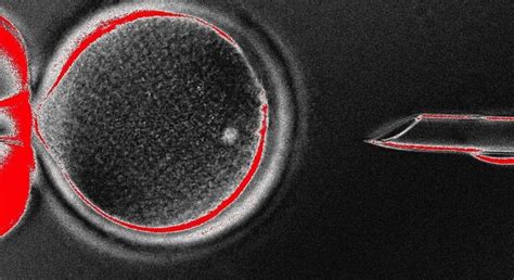 Cell Injection 的图像结果