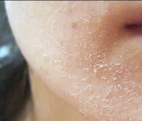 9 Signs From Your Body Which Indicate That You’re Deficient In Vitamins