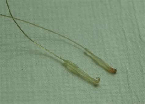 Hair Follicle When Pulled Out at Linda Gary blog