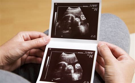 怀孕第9周双胞胎B超图_孕期检查_育儿_99健康网