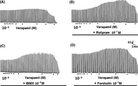 New therapeutic strategy of Alzheimer´s and Parkinson´s diseases ...