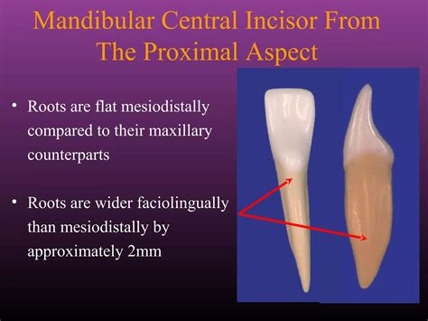 Maxillary Lateral and Mandibular Incisors | PPT