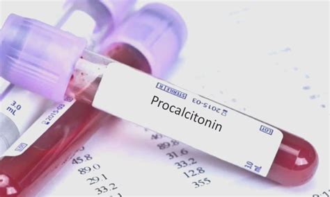 Procalcitonin Testing flops in reducing Antibiotic Duration for ...