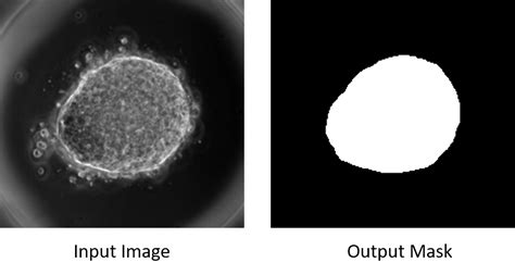 Image Segmentation Using Unet Tensorflow 的图像结果
