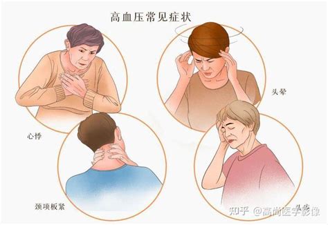 低压 的图像结果