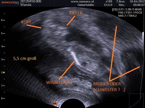 Wurfankündigung Rhodesian Ridgeback Weimaraner mix in Preding | Tiere ...