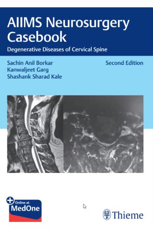 Thieme Webshop - Books, E-Books, Journals, Digital Solutions