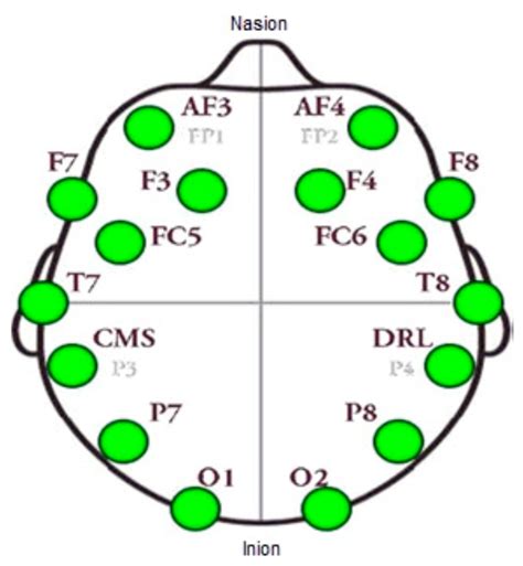 An Emotion Assessment of Stroke Patients by Using Bispectrum Features ...