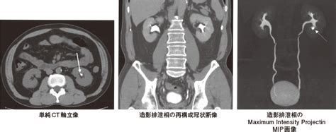 腹部CT検査｜消化器系の検査 | 看護roo![カンゴルー]