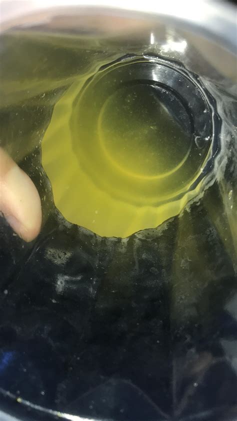 Do White Particles In Urine Mean Infection at Xavier Mccomas blog