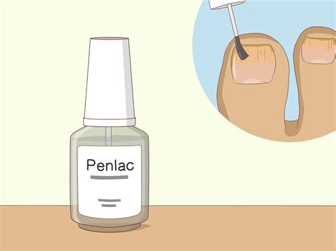 How to Cure Toenail Fungus: Can Vinegar Help?