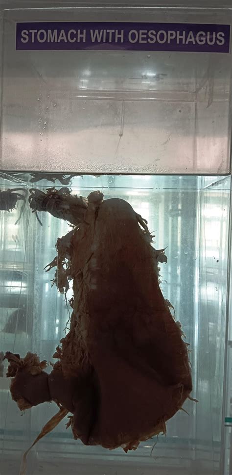 17.STOMACH WITH OESOPHAGUS | NAMO Medical Education & Research Institute