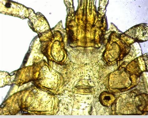 Image result for Magnification Examples