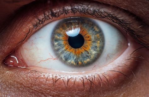 Is It Normal to See Veins in Your Eyes? | San Diego
