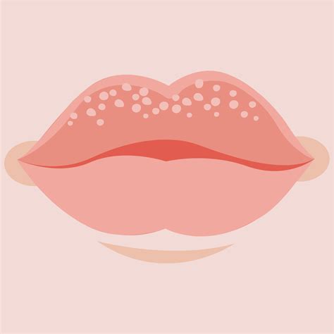 Why Do I Have Tiny White Spots On My Lips - Infoupdate.org
