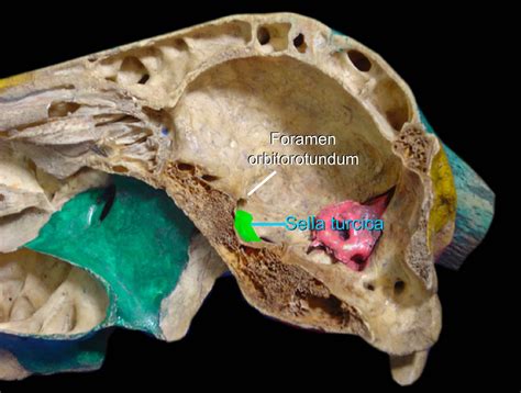 Sphenoid Bone of Domestic Animals | Cranial bones