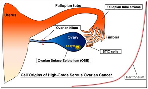 Cell Origins of High-Grade Serous Ovarian Cancer