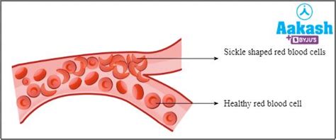 Haemoglobin: Structure, Types, Functions, Common Disorders, Practice ...