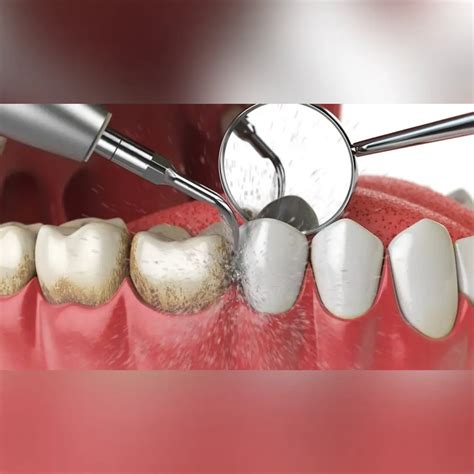 Best Dentist in Gaur City – Get 10–15% OFF Today.