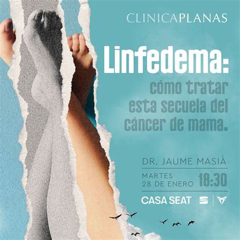 Linfedema: qué es y por qué ocurre -Tu blog de medicina y cirugía ...