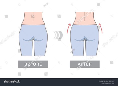 Hip Dips Before After Comparison Perfect Stock Vector (Royalty Free) 2571267823 | Shutterstock