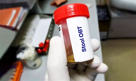 Image result for Stool Sample Collection Procedure