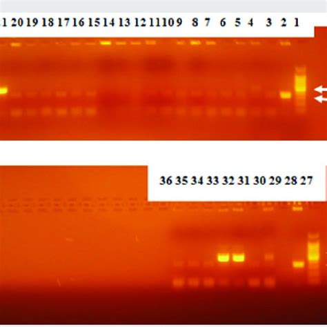 Image result for Acid-Fast Bacilli Staining Method
