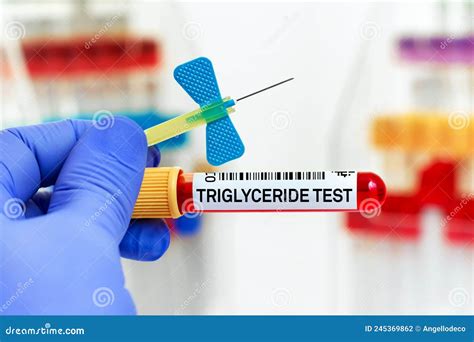 Doctor Holding Blood Tube for Triglycerides Analysis Stock Photo - Image of disease, healthcare ...