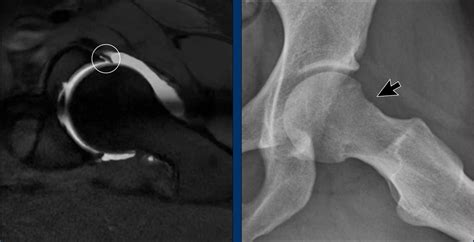 Image result for Python Medical Image Processing