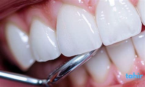 Why Your Oral Care Routine Needs an Upgrade: Benefits of Electric Flos ...