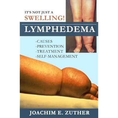 Joachim Zuther It's Not Just a Swelling! Lymphedema: Causes, India | Ubuy