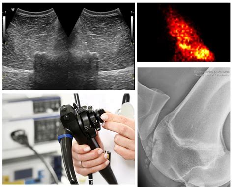 Diagnostic imaging - Equihealth