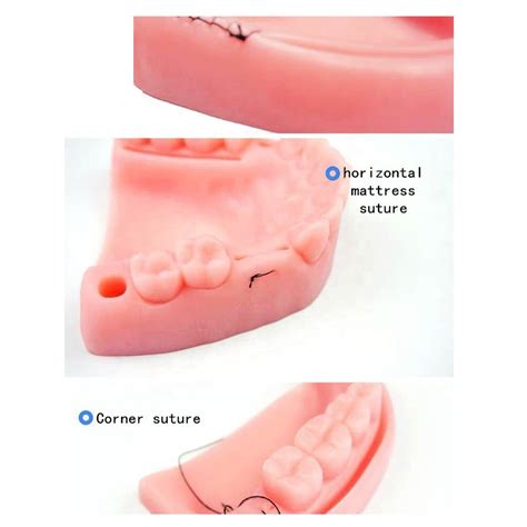Dental Suture Tooth Kit With Instruments - FH-001 Suture kits is a sil ...