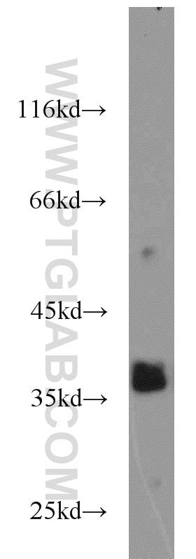 SIX1 antibody (10709-1-AP) | Proteintech
