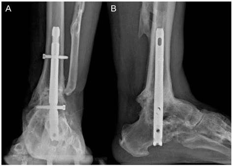 JCM | January-2 2025 - Browse Articles