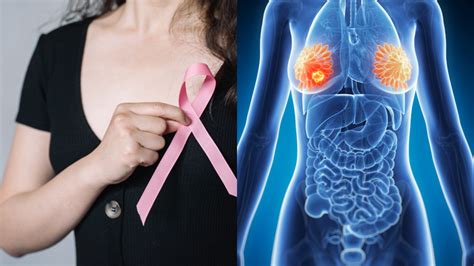 Man Who Missed Turns While Driving, Misplaced Things Diagnosed With ...