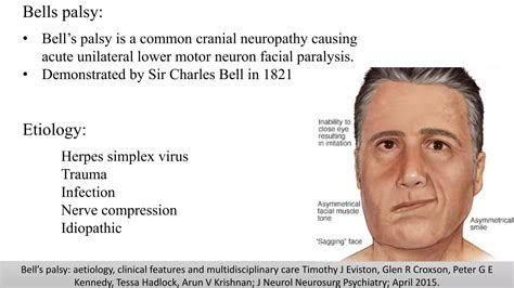 Facial nerve | PPTX