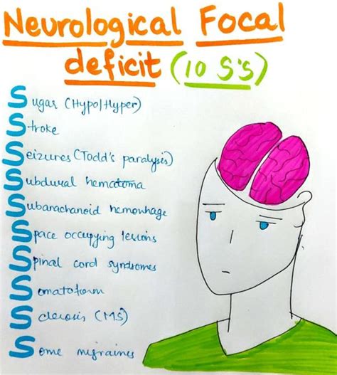 Neurological Focal Deficit (10 S’s) – Causes, Symptoms, Diagnosis ...