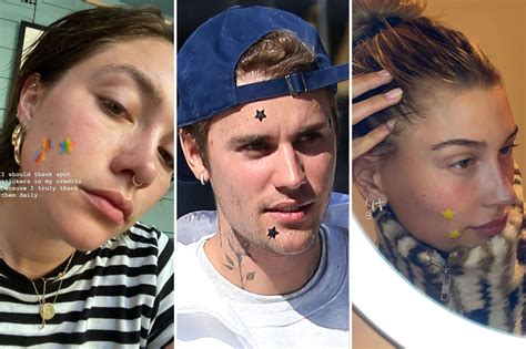 Celebrities love Starface pimple patches