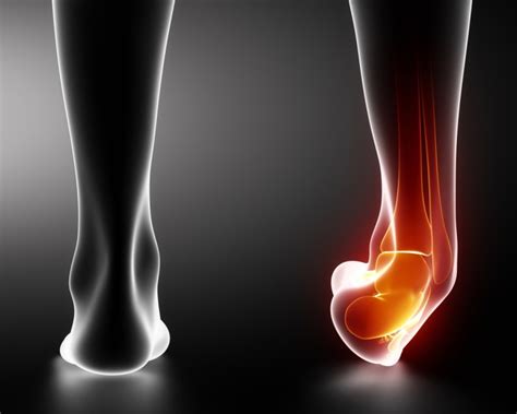 Ankle Sprain Treatment in Gurgaon | Best Physiotherapist | Dr Rajesh Pal