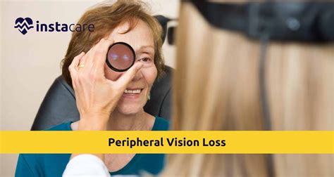 Image result for Peripheral Vision Loss